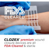 Clozex Dispositivo de cierre de heridas: reparación de 3 laceraciones individuales de 3 3/8 pulgadas sin puntadas